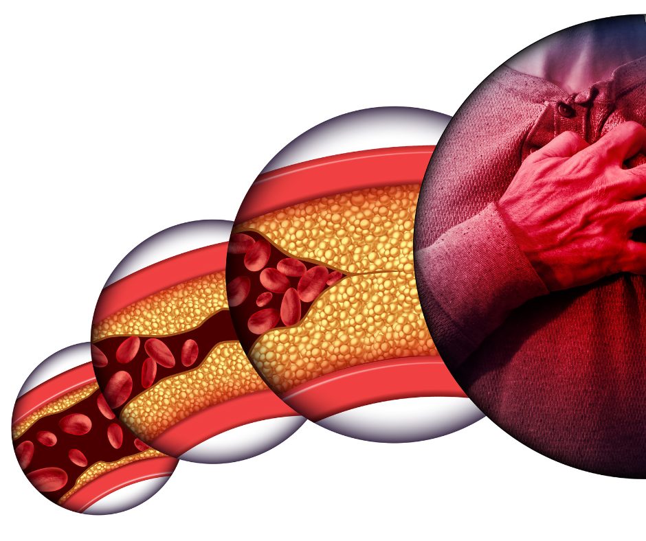 Warning Signs of Heart Disease